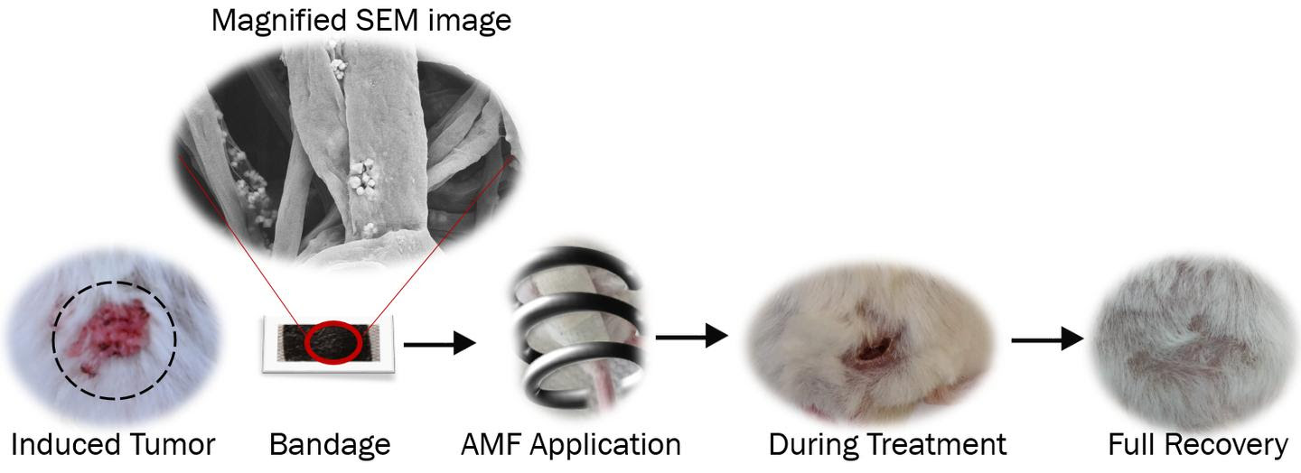 Diagram demonstrates the effectiveness of treatment with a newly developed magnetic bandage