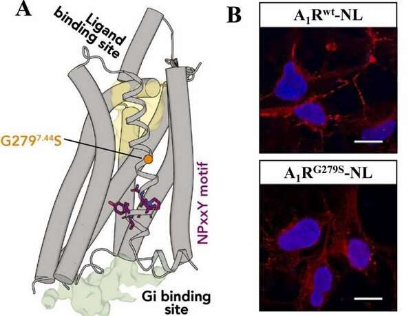 Researchers identify molecular mechanism associated with juvenile Parkinson's