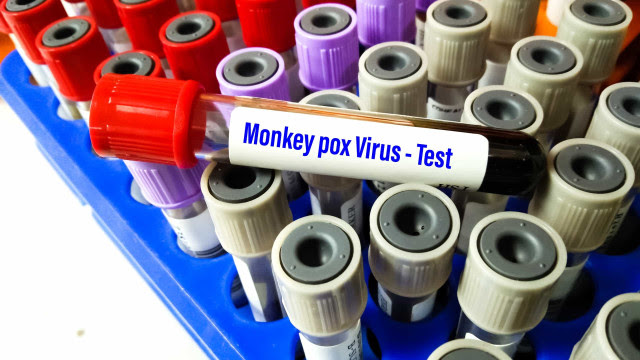  EUA registram 2 casos de varíola dos macacos em crianças pela 1ª vez
