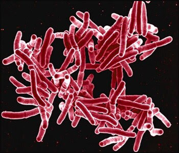 The figure above is an electron micrograph depicting a grouping of red-colored, rod-shaped Mycobacterium tuberculosis bacteria.