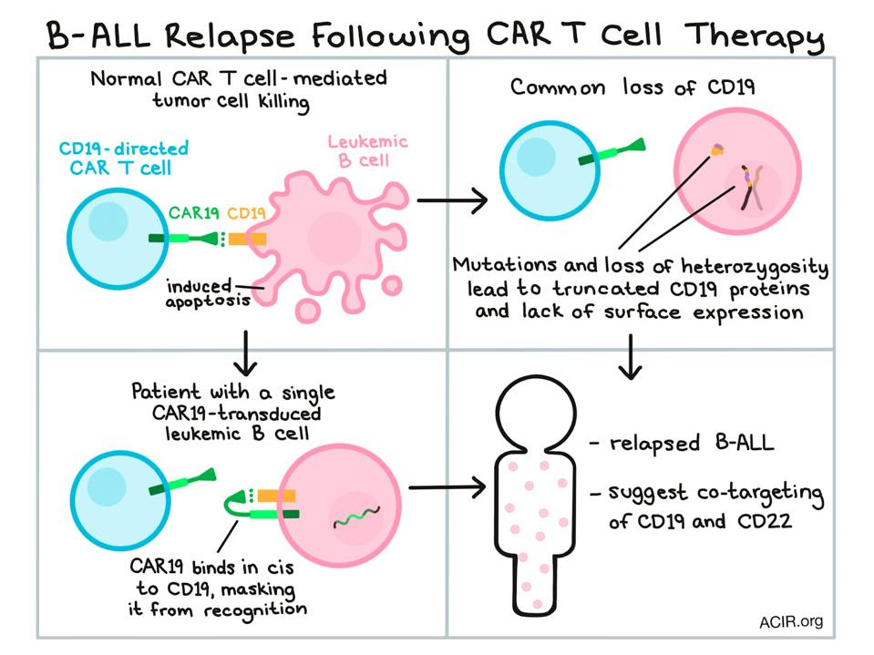 Cancer cells escape antigen recognition of CAR T cells