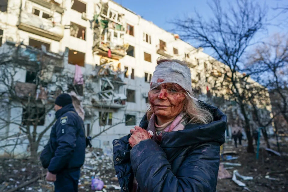 A wounded woman is seen after an airstrike damaged an apartment complex in city of Chuhuiv, Kharkiv Oblast, Ukraine, on Feb. 24, 2022. <span class=copyright>Wolfgang Schwan/Anadolu Agency via Getty Images</span>