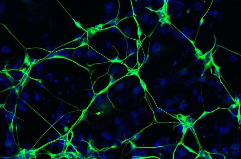 Deteriorating neurons are source of human brain inflammation in Alzheimer's disease