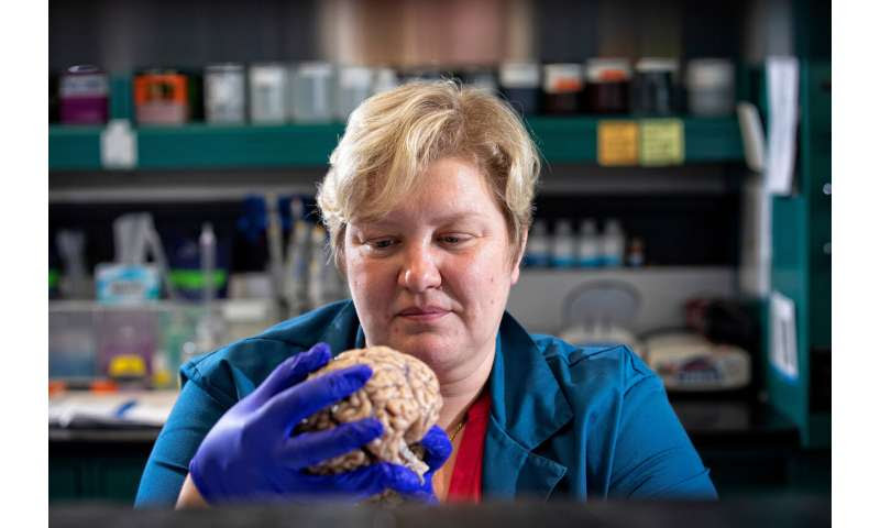 University of Ky study leads to potential for new treatment approach to Alzheimer's