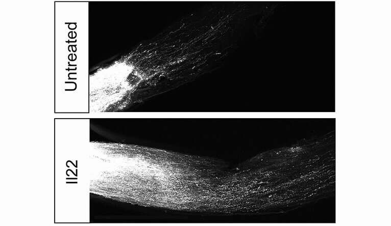 Yale team finds dozens of genes that block regeneration of neurons