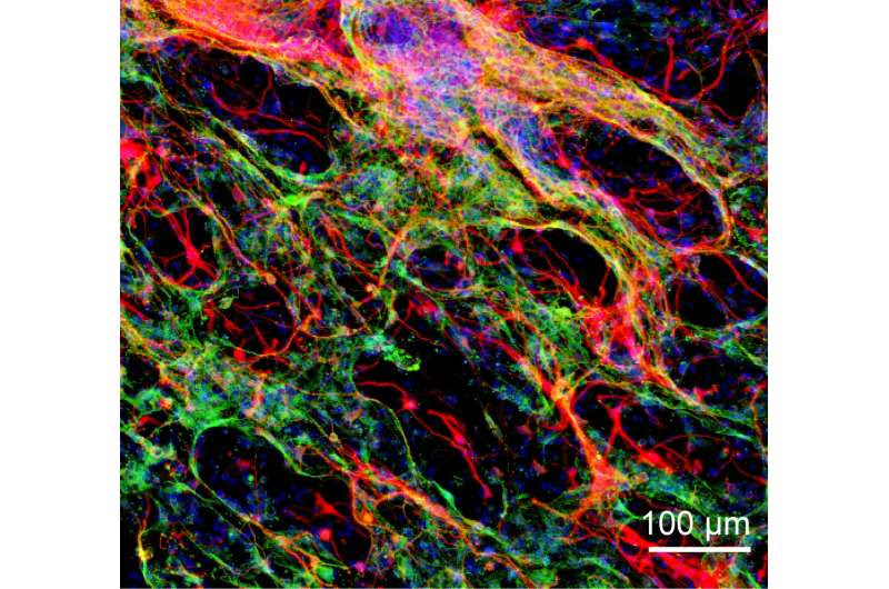 Healing the brain: Hydrogels enable neuronal tissue growth