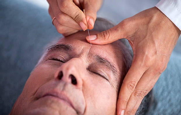 A man receiving acupuncture on his forehead.