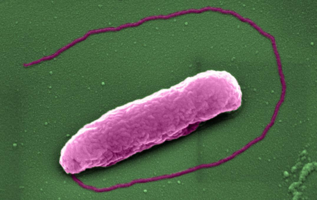 The superbug Pseudomonas aeruginosa, prior to being "popped like a balloon" in new superbug research