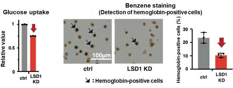 Unraveling the mechanisms that create the individualized metabolism in leukemia