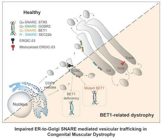 Researchers identify a crucial gene that triggers congenital muscular dystrophy