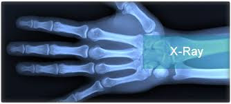 Image result for x ray