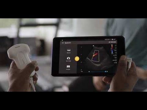 Introduction to hand-held ultrasound