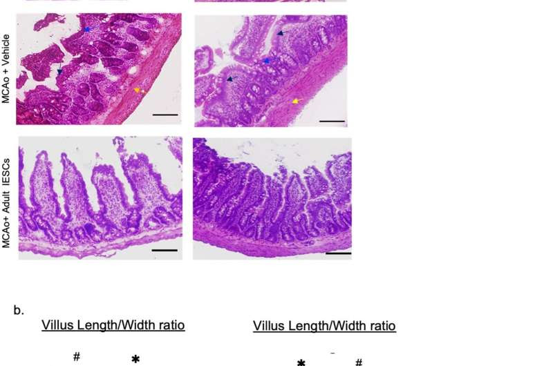 Repairing gut saves brain function after stroke