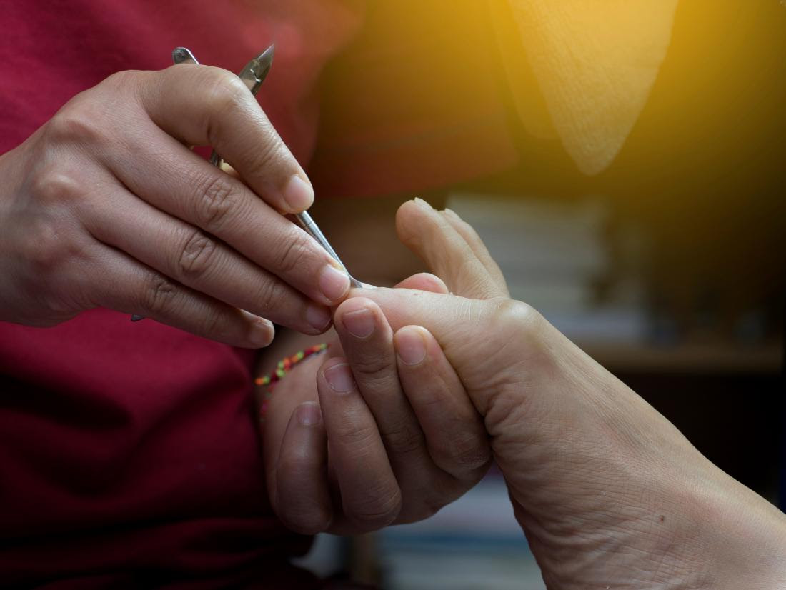 A woman showing How to cut an ingrown toenail