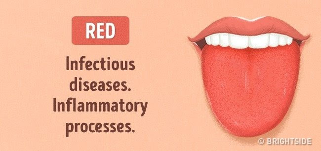 Màu đỏ: Bệnh nhiễm trùng, sự phát triển của viêm nhiễm