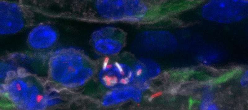 Discovery of an immune escape mechanism promoting Listeria infection of the central nervous system