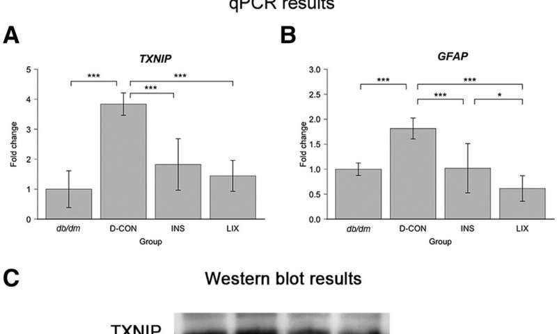 Scientists identify a potential treatment candidate for early type 2 diabetic retinopathy