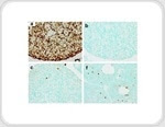 TUNEL Staining: An Overview