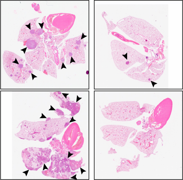 : C26 suppresses metastasis