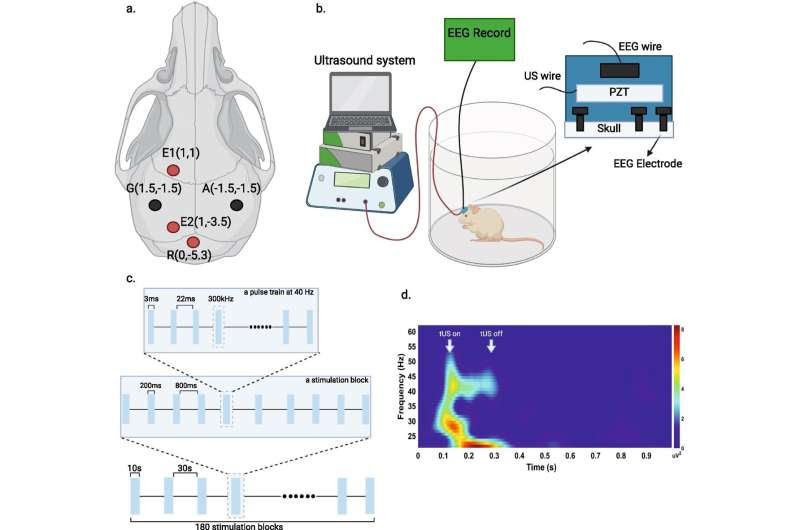 Transcranial ultrasound used in mice with Alzheimer's disease features