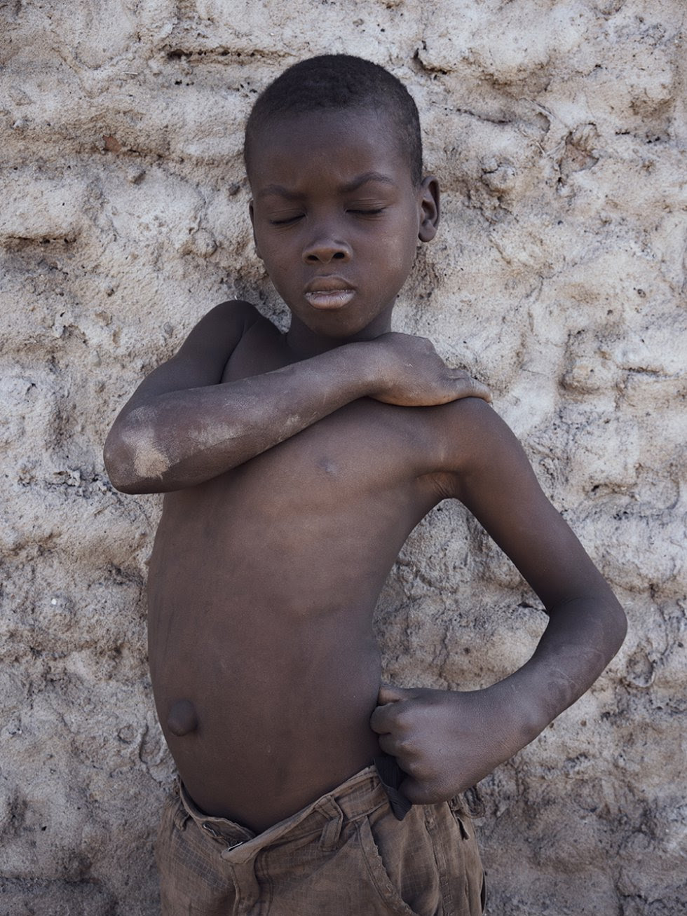 Un niño descansa a la sombra de una casa en el barrio de Bagamoyo.