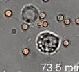 File:S4-J774 Cells with Conidia in Liquid Media.ogv