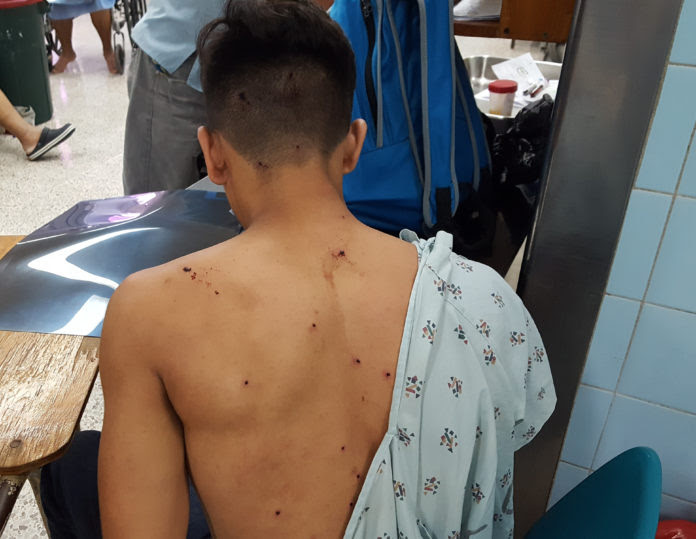 herido