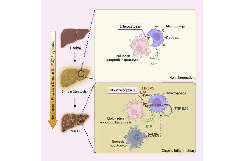 Immunologists uncover obesity-linked trigger to severe form of liver disease