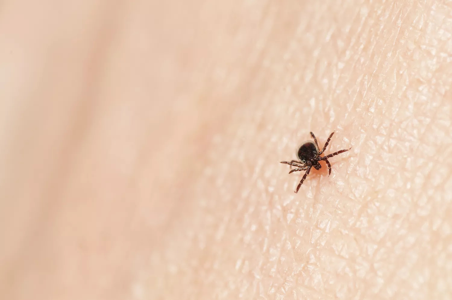 black-legged tick on human skin