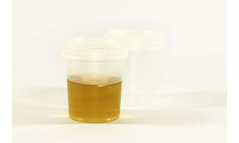 urine