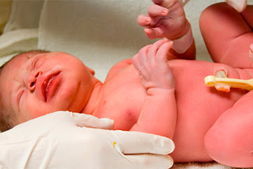 Test de Apgar, la primera prueba que le harán a tu bebé recién nacido, ¿cómo se interpreta?