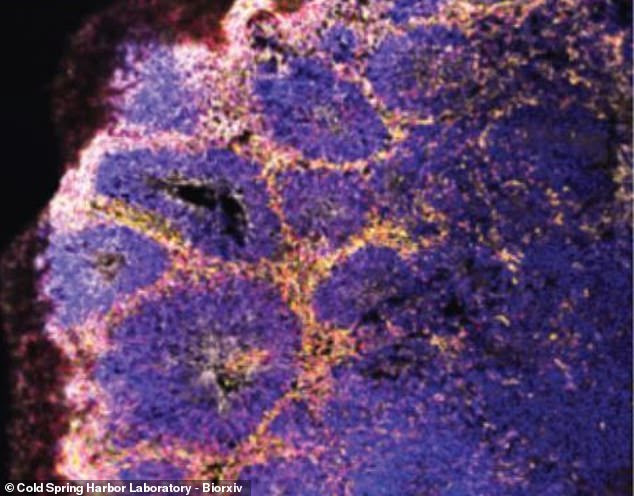 A microscope image shows one of the lab-grown brain organoids that researchers infected with coronavirus to see how the virus took over cell machinery and deprived nearby neurons of oxygen. They also observes antibodies that help to prevent the virus from latching onto a particular receptor at work (white), suggesting antibodies can prevent brain infection