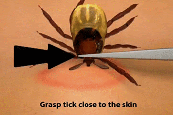 animated-tick-removal