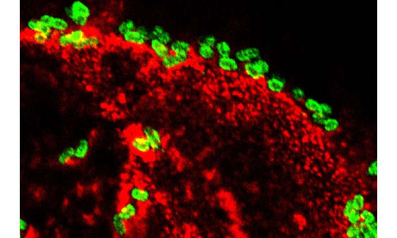 Toxin provides clues to long-term effects of diarrhea caused by E. coli