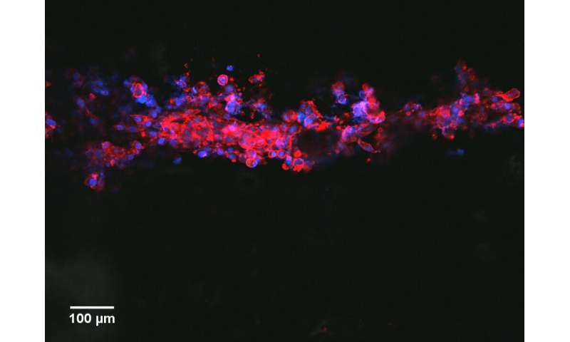 Printable ink guides cell growth, offers nerve injury hope