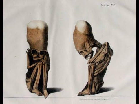 EVIDENCE! "Human" Fetus With Elongated Skull Found In Bolivia!  Hqdefault