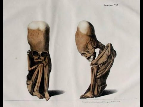 EVIDENCE! "Human" Fetus With Elongated Skull Found In Bolivia! Hqdefault