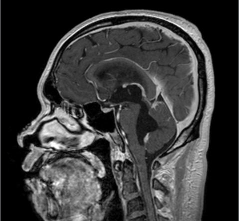 Magnetic Resonance of Patient