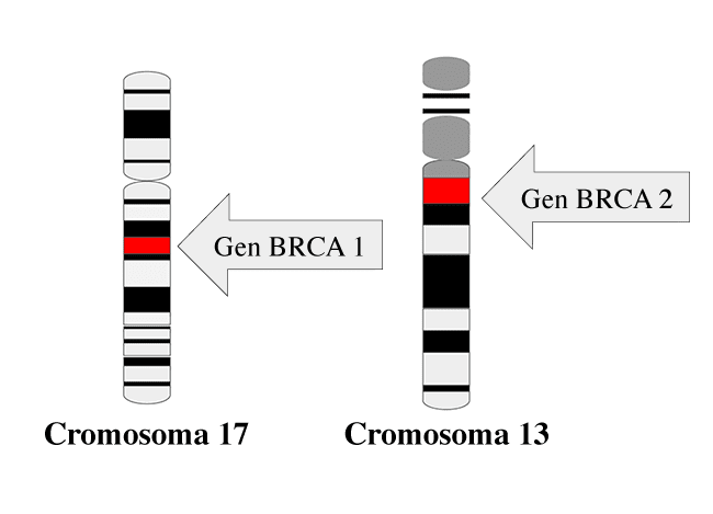 Dibujo de chromosomas 13 y 17 con genes BRCA1 y BRCA2