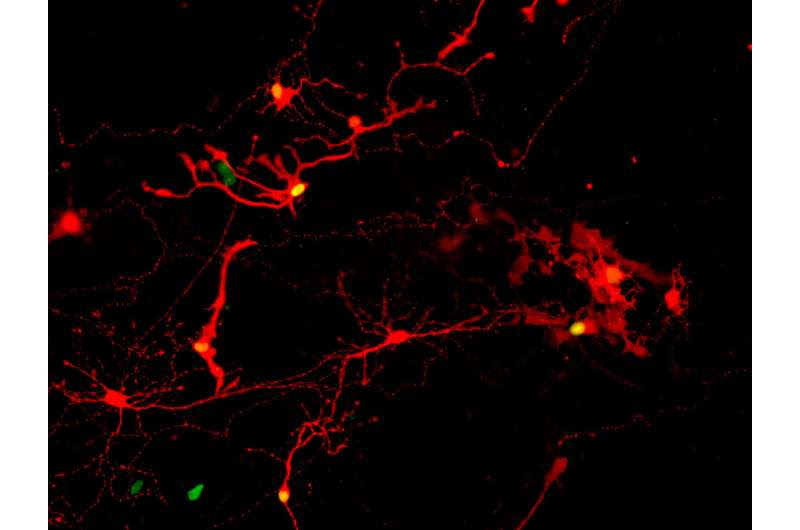 Lab-grown retinal eye cells make successful connections, open door for clinical trials to treat blindness