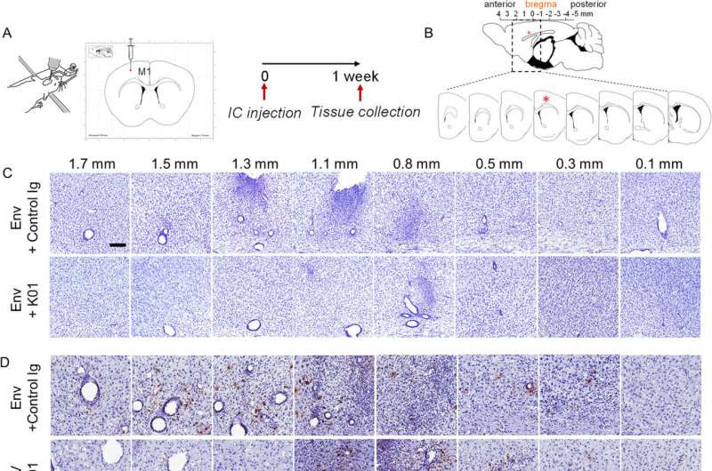 Researchers identify possible treatment target for a type of sporadic ALS