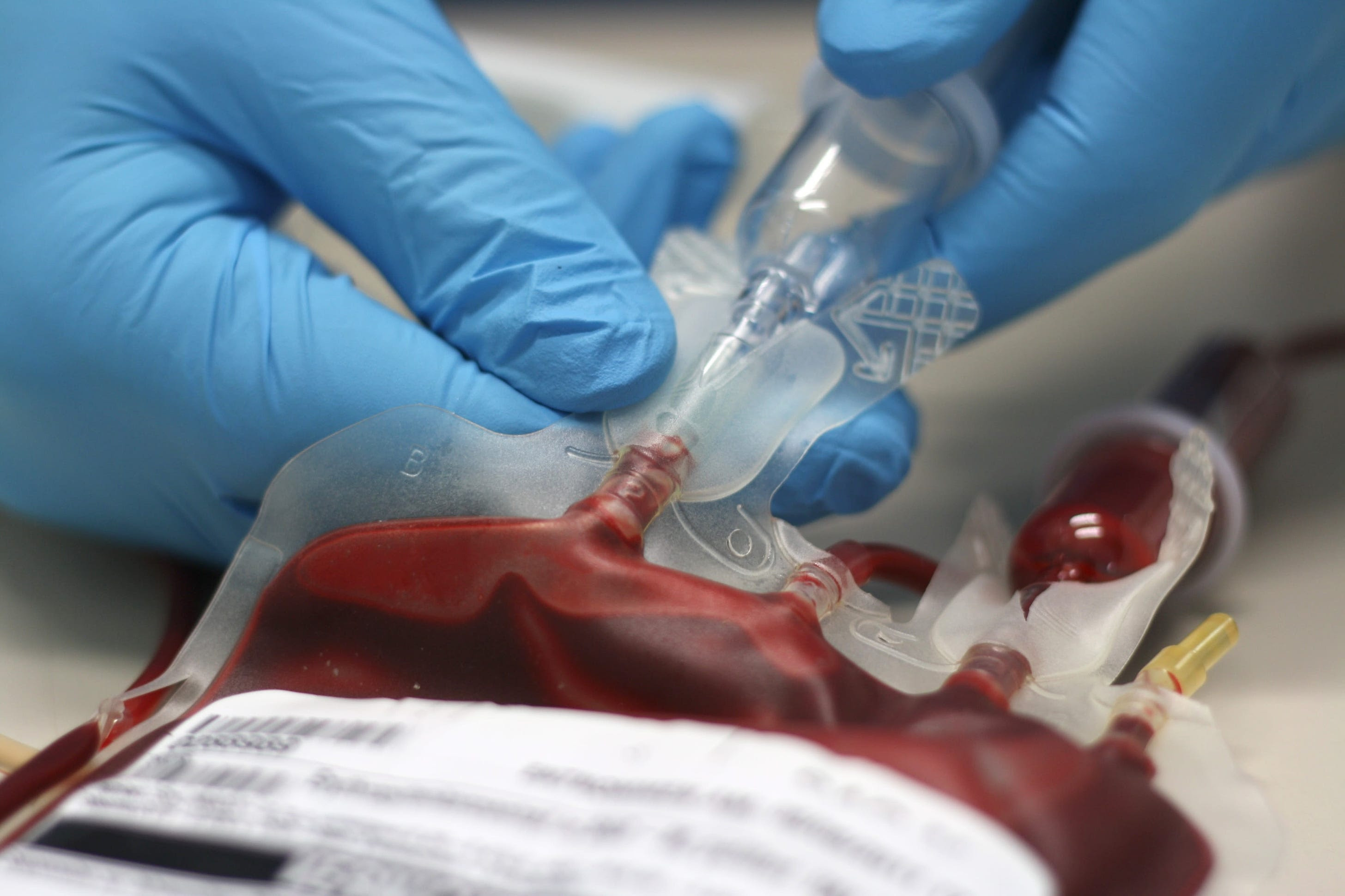 UK to launch inquiry into tainted blood product that killed 2,400 | CNN